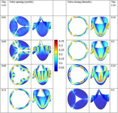 Design and Analysis of Prosthetic Heart Valves and Assessing the Effects of Leaflet Design on the Mechanical Attributes of the Valves